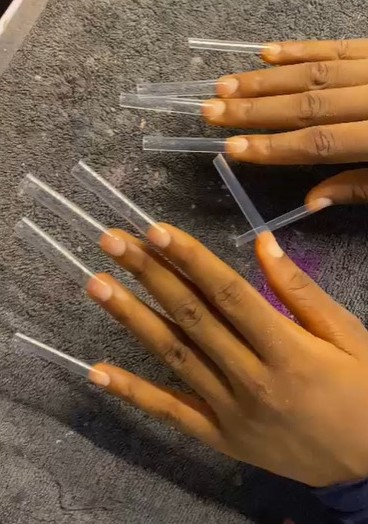 Before Nail Transformation